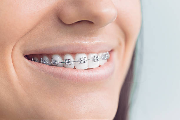 Best Invisalign and Clear Aligners  in Cave Springs, AR